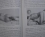 Собрание книг "Хирургические операции". 5 томов. 1922-1923 год. Лейпциг, Веймар, Германия. 